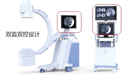 雙監(jiān)雙控C臂機PLX112C 雙監(jiān)雙控C臂機PLX112C